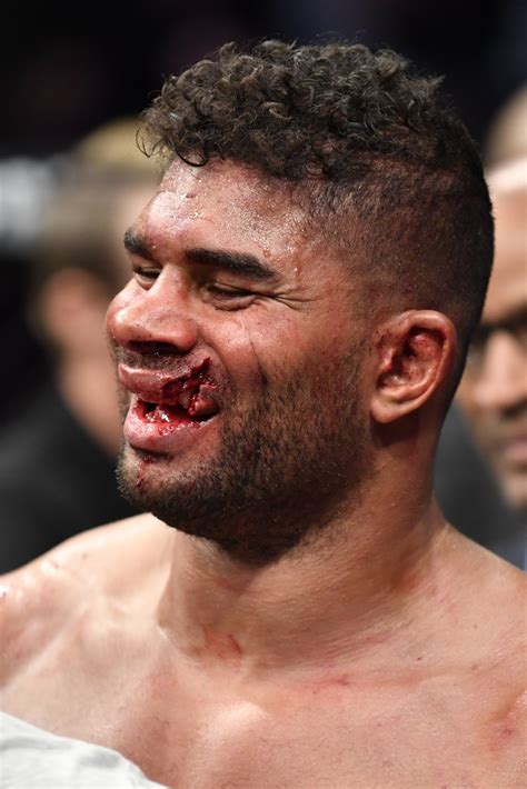 Aug 26, 2021 · alistair overeem was gracious and encouraging of brock lesnar immediately following the latter's retirement from ufc years ago, but his views have apparently changed over the years. Jairzinho Rozenstruik slaat Overeem vier seconden voor het ...