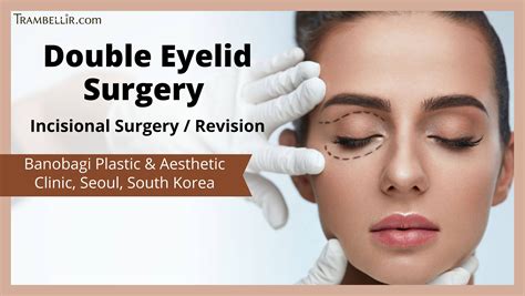 Double Eyelid Surgery Incisional Surgery Revision Trambellir