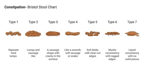 Constipation Bristol Stool Chart Gi Update