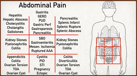 Common Causes Of Abdominal Pain According To Location Medizzy