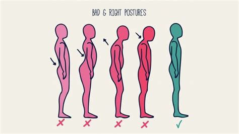 How Your Posture Should Be And How To Improve It