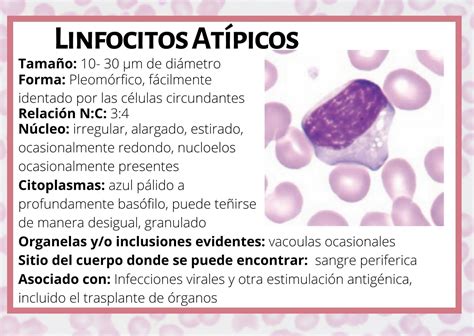 Linfocitos At Picos Anatomia Patologica Hematolog A Presentaciones