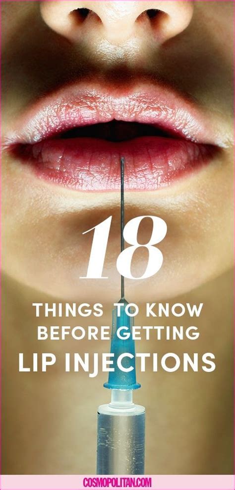 20 Things You Should Know Before Getting Lip Injections Lip