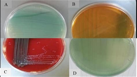 Pyocyanin Dye Products From Paeruginosa On A Nutrient Agar