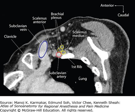 Sonoanatomy Relevant For Ultrasound Guided Upper Extremity Nerve Blocks