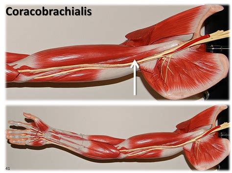 Coracobrachialis Large Arm Model Muscles Of The Upper E Flickr