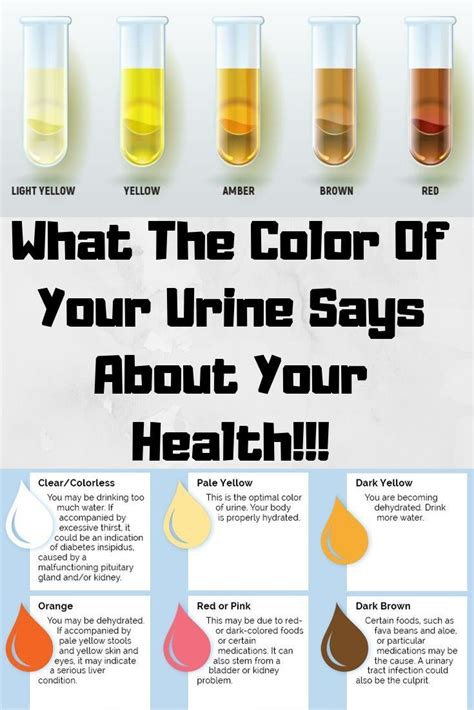 Here S What The Color Of Your Urine Says About Your Health Health Hot Sex Picture
