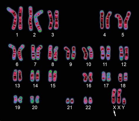 Karyotype Chromosome Britannica