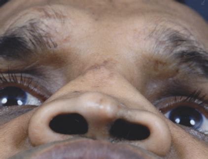 Open Gable Roof Advantages And Disadvantages - Hip Roof Advantages And Disadvantages