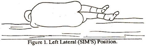 The digital rectal examination (dre, latin palpatio per anum or ppa) is a relatively simple procedure. JPMA - Journal Of Pakistan Medical Association