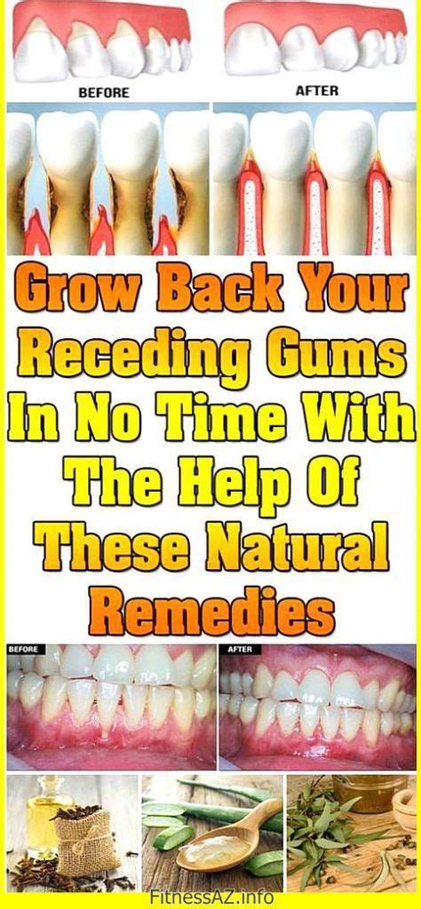 Grow Back Your Receding Gums With These Natural Remedies