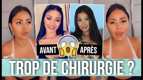 Maeva ghennam avant la chirurgie, une photo refait surface. Maeva Ghennam réagit aux critiques concernant la chirurgie esthétique ! - Toutes les actualités ...