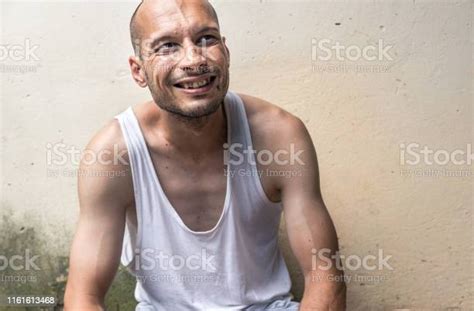 Young Skinny Anorexic Bald Positive And Happy Smiling Homeless Man