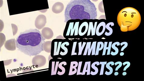 Reactive Lymphocytes Vs Monocytes