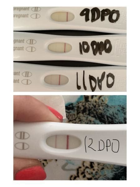 9 Dpo 12 Dpo Frer Does My Progression Look Ok Out Of Town So I