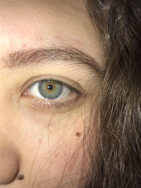 Hazel Eyes Or Central Heterochromia Ive Always Thought That I Have Are