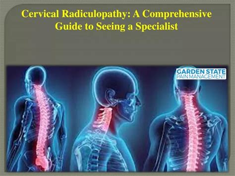 Ppt Cervical Radiculopathy A Comprehensive Guide To Seeing A