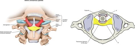 Craniocervical Instability The Anterior Atlanto Occipital Ligament