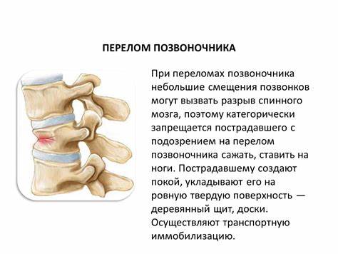 Компрессионный перелом позвоночника диета Презентация на тему: "Переломы костей" Презентация на тему: "Переломы костей" Компрессионный перелом позвоночника диета