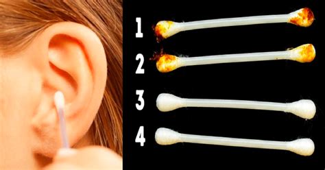 Your Earwax Can Indicate Your Health And Conditions What Color Is
