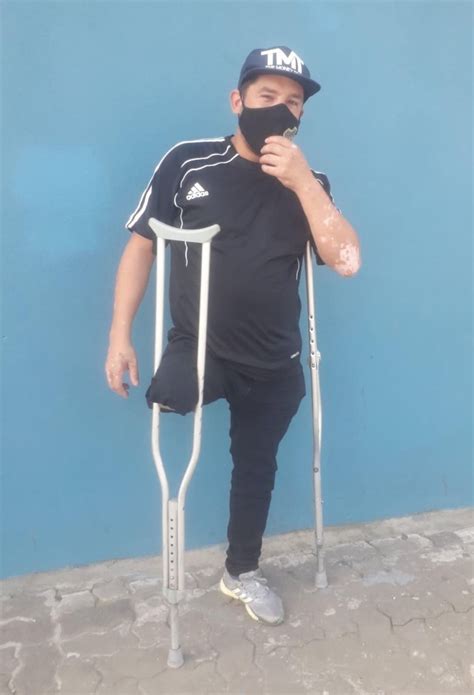 Fabulous Crutching Above Knee Amputee Men — 3 Handsome Boyz — 3 Legs —3