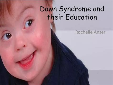 Ppt Down Syndrome And Their Education Powerpoint Presentation Free