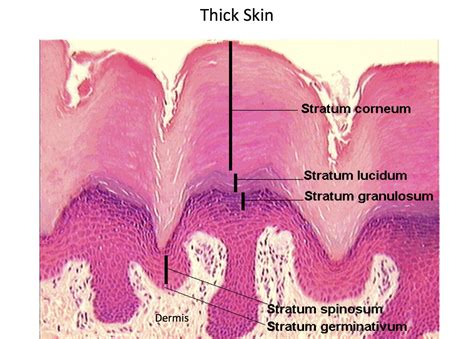 Thick Skin Epidermal Layers Histology Histología