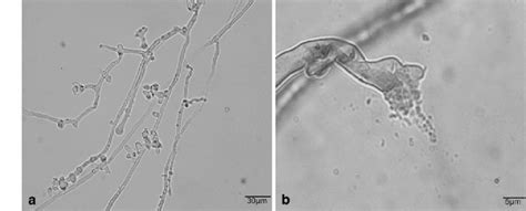 Light Microscopy Of The Hyphal Morphology Of Phytophthora Cinnamomi