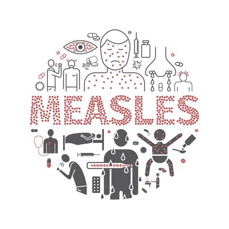 Measles What You Need To Know Premier Medical Group