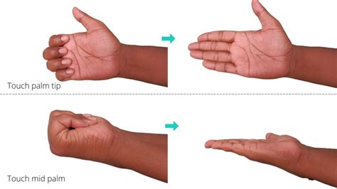 5 Easy Dupuytrens Contracture Exercises For Finger Pain Relief