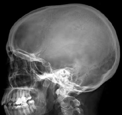 Radiografía del cráneo vista de perfil Objetivo Reconocer tipo de hueso y su función Marcar