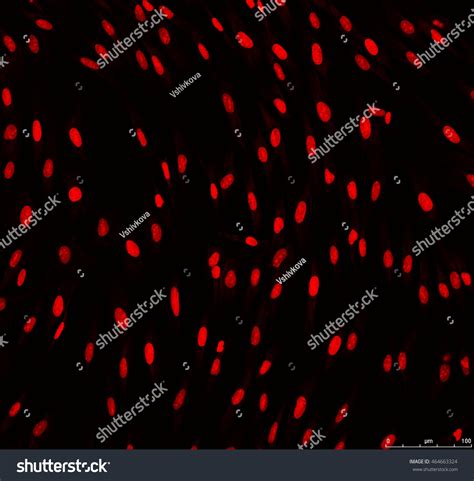 Real Fluorescence Microscopic View Human Skin Foto Stock 464663324