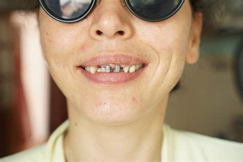 Toothless Woman Images Browse 1508 Stock Photos Vectors And Video