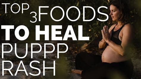 How To Heal A Puppp Pregnancy Rash With Foods Youtube