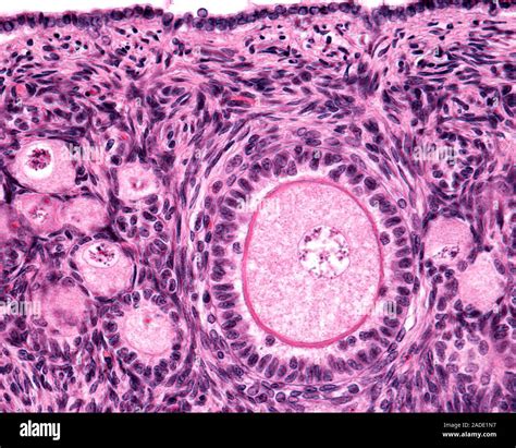 Micrografía de luz de un folículo primario de ovario mostrando el