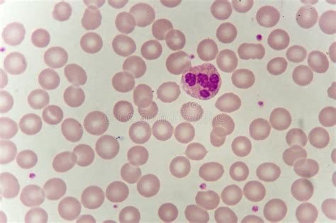 Neutrophil Cell Stock Photo Image Of Monocyte Erythrocyte 92593994