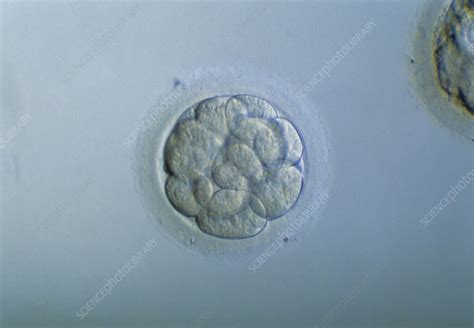 Morula Embryo Stock Image P6800494 Science Photo Library