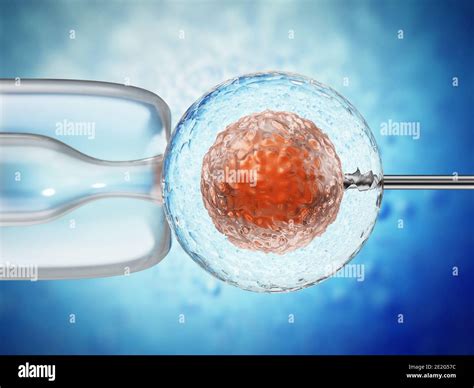 D Illustration Of Artificial Insemination Process Showings Sperms