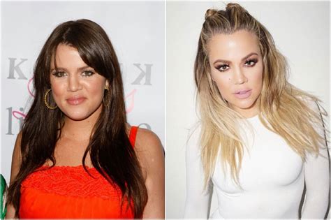 Kardashians Before And After Plastic Surgery Her Beauty