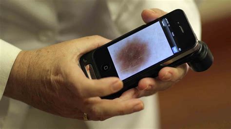 Dial A Diagnosis Detecting Skin Cancer With A Mobile Phone Sydney