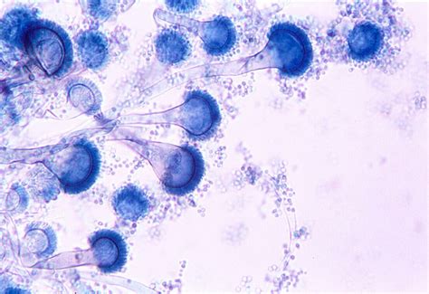 Immune Cells Trigger Spore Suicide Stopping Fungal Infection