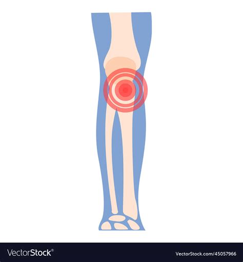 Knee Arthritis Icon Cartoon Joint Pain Royalty Free Vector
