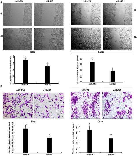 MiR 224 Promoted The Migration And Invasion In Cervical Cancer