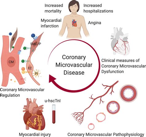 Establishing The Link Between Coronary Microvascular Disease And