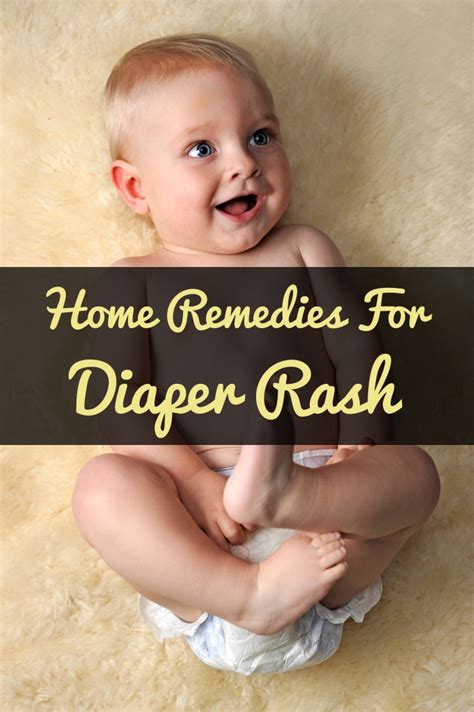 Dos Donts And 6 Home Remedies For Diaper Rash Treatment