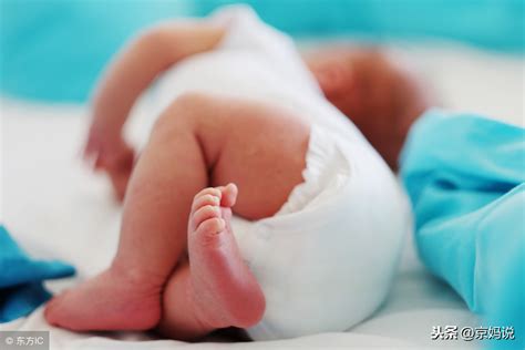 1个月婴儿肚脐正常图片（大便时间轴） 幼儿百科 魔术铺