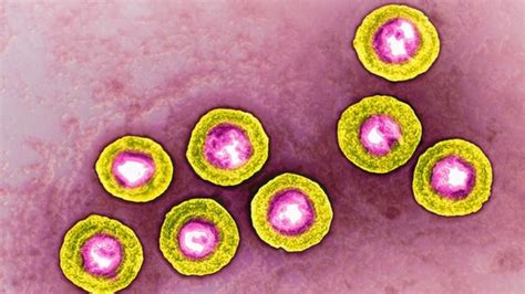 Cancer Killing Virus Shows Promise In Patients Bbc News