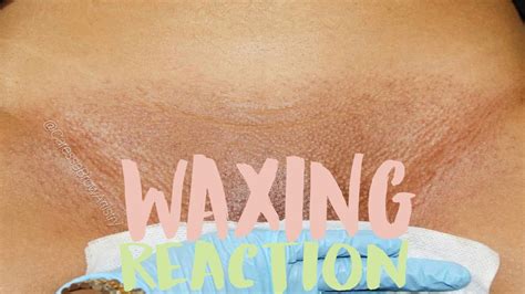 The Brazilian Wax A History And How To Travelweeksaopaulo