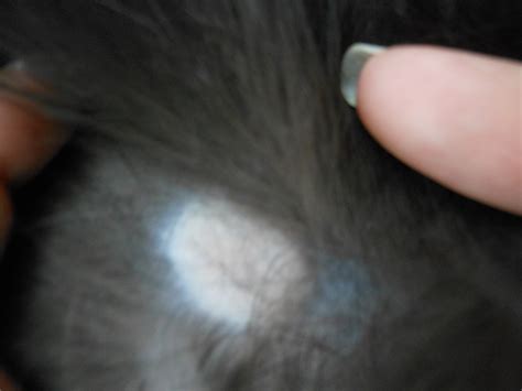 15 Hq Images Bald Spot On Cat Tail 3 Signs That Your Cat May Have