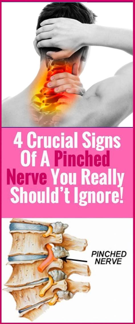 4 Crucial Signs Of A Pinched Nerve You Really Should’t Ignore Healthy Lifestyle